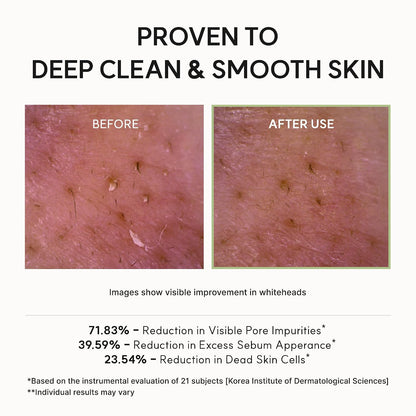 Pure Radiance All-in-One Face Cleanser